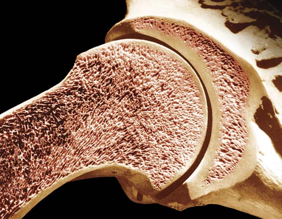 Cancellous bone