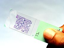 Tissue Microarrays 