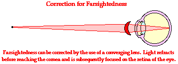 How to solve farsightedness using&nbsp;physics